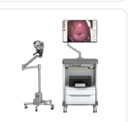Digital Electronic Colposcope