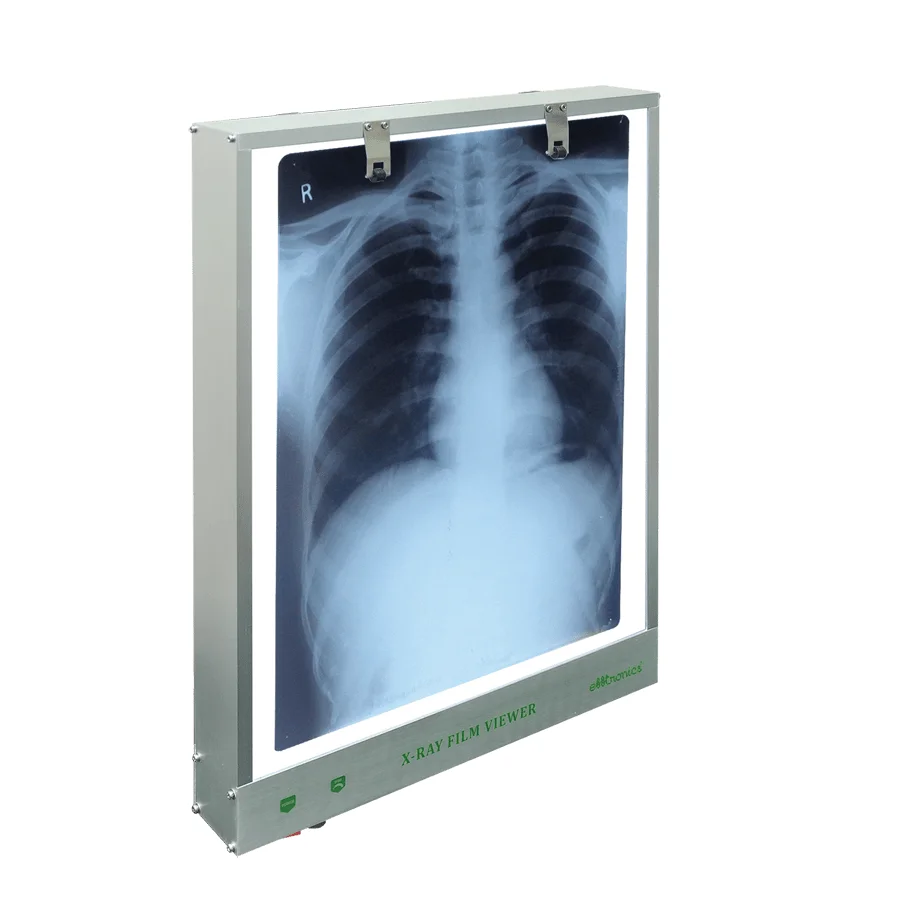 X Ray Viewer
